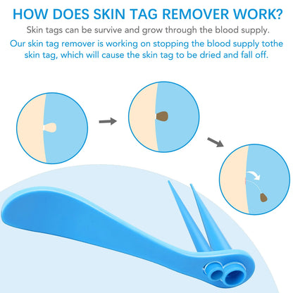 Skin Tag Removal Mole Wart Removal Facial Mole Wart Microstrip Tag Removal Kit Automatic Mole Remover Tool with Cleansing Swabs