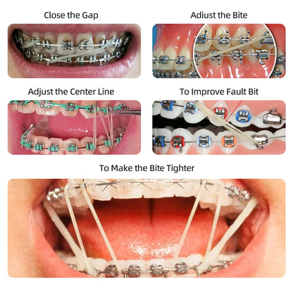 TJdent 5000Pcs/Box Dental Orthodontic Elastics Rubber Bands Zoo Pack Latex Braces Ligation Ring 3.5OZ Dentistry Material