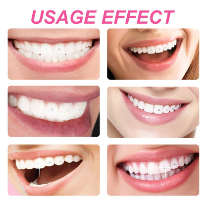 Tooth Gem Glue Dental Adhesive for Tooth Gems Diamond Kit Glue Teeth Crystal Jewelry Sturdy Tooth Jewelry Orthodontic Gel 7/10ml