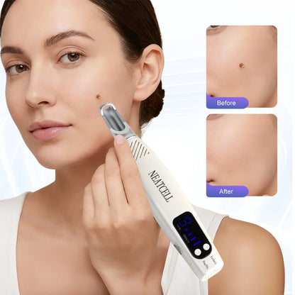 Picosecond Laser Pointer for Mole Removal Dark Spot Removal Pen Tattoo Acne Skin Pigment Portable Removal Machine Beauty Device
