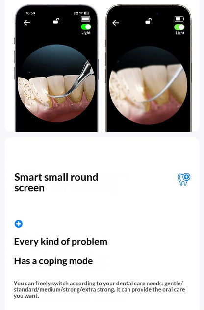 HOMEFISH Home Dental Cleaning Device Professional Tool for Removing Tartar Plaque And Calculus with Visual Technology