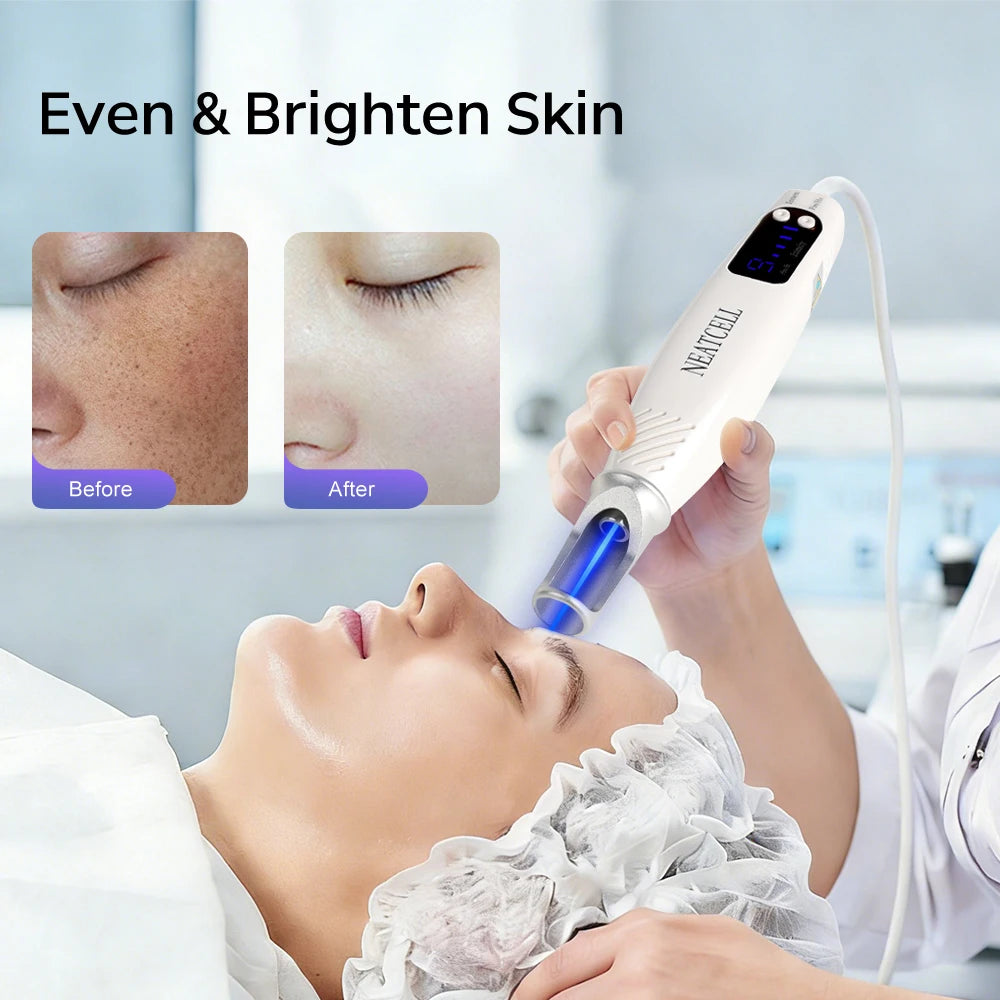 Picosecond Laser Pointer for Mole Removal Dark Spot Removal Pen Tattoo Acne Skin Pigment Portable Removal Machine Beauty Device