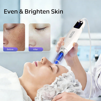 Picosecond Laser Pointer for Mole Removal Dark Spot Removal Pen Tattoo Acne Skin Pigment Portable Removal Machine Beauty Device