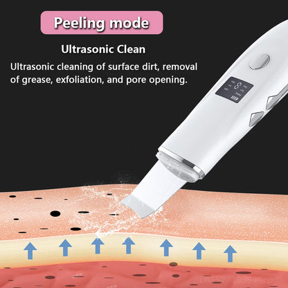 Ultrasonic Face Scrubber Facial Peeling Skin Scrubber Deep Facial Cleaning Spatula Acne Pore Ultrasonic Scrubber Facial Cleanser