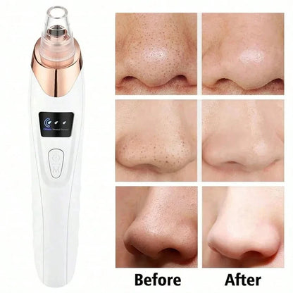 Electric Pore Cleaner & Blackhead Remover - Deep Cleansing Vacuum Device for Facial Care Face Skin Care Tools