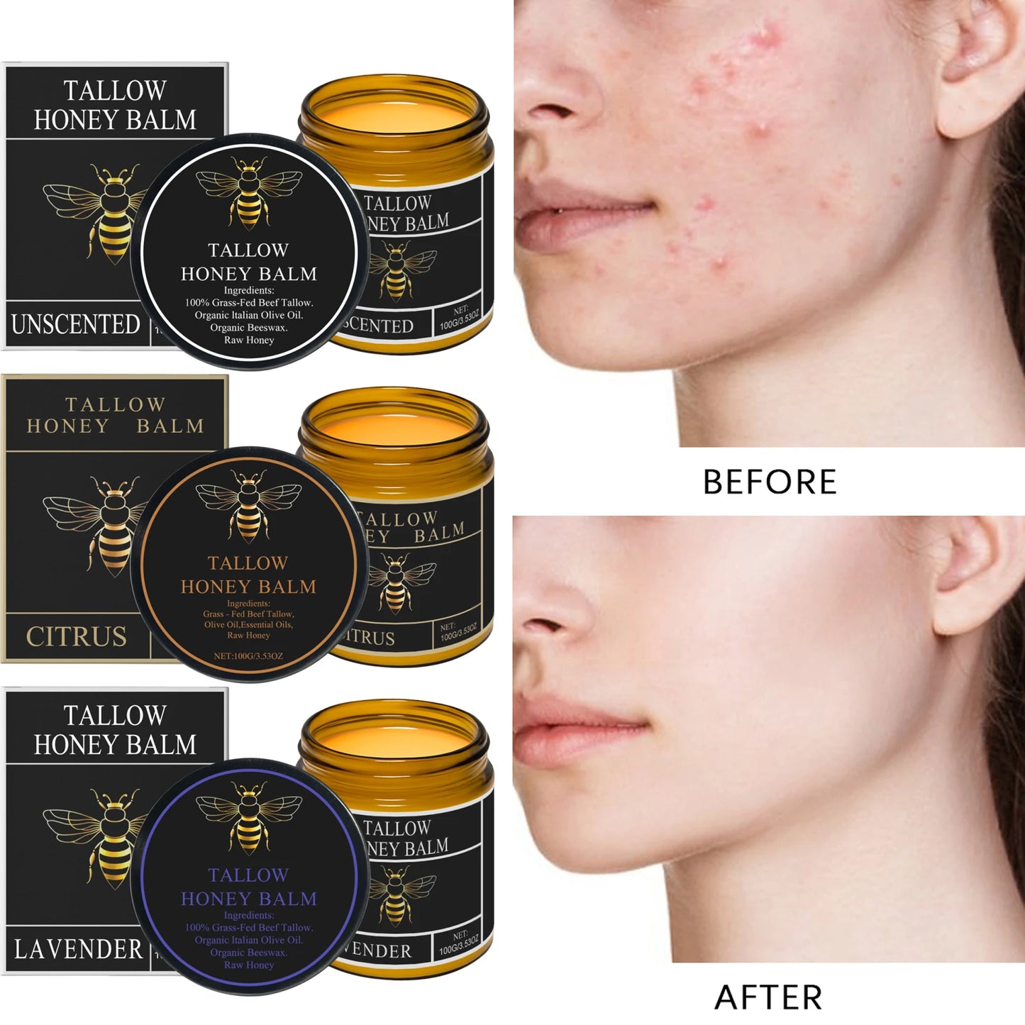 Beef Tallow Honey Moisturizer Grass Fed Whipped Tallow Face Cream Body Lotion Non Greasy Nourishing Fast Absorption Skin Care