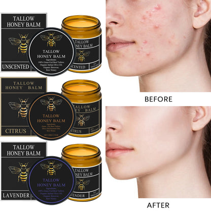 Beef Tallow Honey Moisturizer Grass Fed Whipped Tallow Face Cream Body Lotion Non Greasy Nourishing Fast Absorption Skin Care