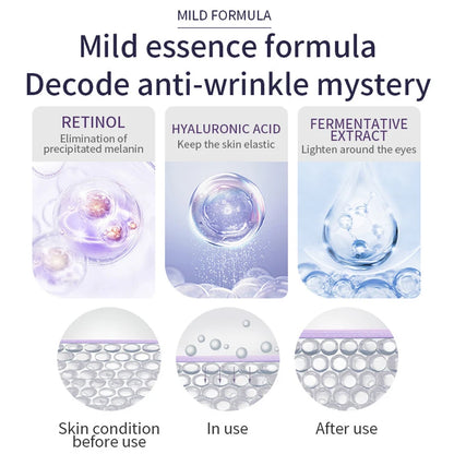 Anti Wrinkle Anti Dark Circle Eye Cream Roller Massager Moisturizing Eye Bags Anti Aging Hyaluronic Acid Eye Skin Care Products
