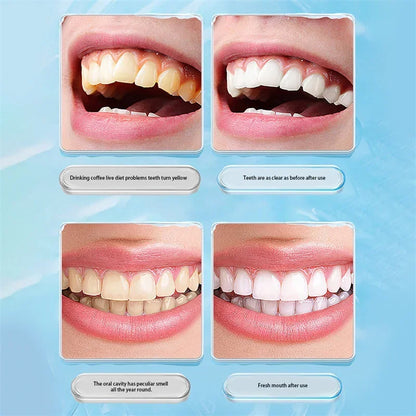 1/3/5PCS Teeth Stain Eraser Sponge Remover Tartar/Tea/ Smoke Stains Orthodontic Toothbrush Oral Care Interdental Brush Teeth