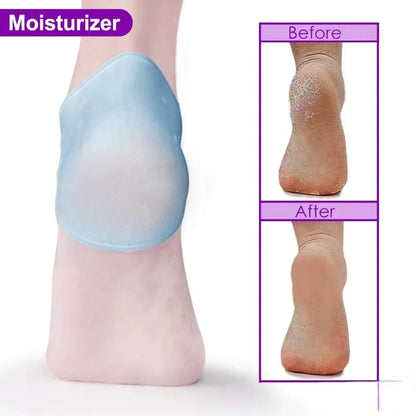 2PCS Achilles Tendonitis Bone Spur Aching Feet Relieve Pain Pedicure Tools Heel Cushion Gel Heel Protector for Plantar Fasciitis
