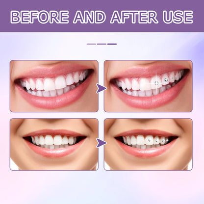 Tooth Gem Glue Dental Adhesive for Tooth Gems Diamond Kit Glue Teeth Crystal Jewelry Sturdy Tooth Jewelry Orthodontic Gel 7/10ml