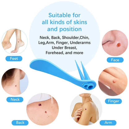 Skin Tag Removal Mole Wart Removal Facial Mole Wart Microstrip Tag Removal Kit Automatic Mole Remover Tool with Cleansing Swabs