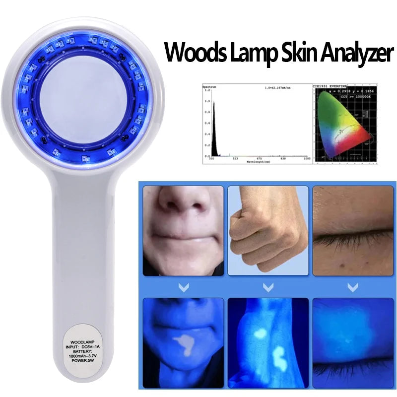 NEW Woods Lamp Skin Analyzer Portable Facial Salon Beauty Analyzer UV Lamp Wood Dermatology for Analyzing Testing Examination