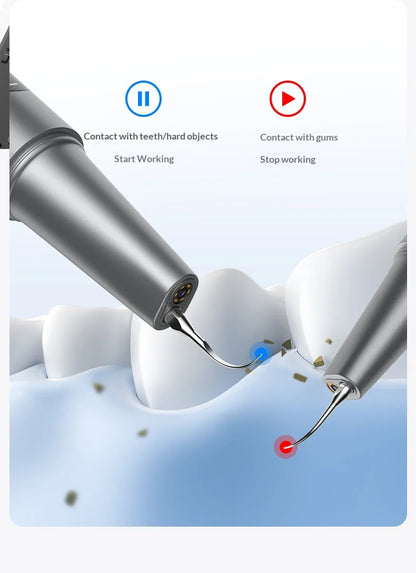 HOMEFISH Home Dental Cleaning Device Professional Tool for Removing Tartar Plaque And Calculus with Visual Technology