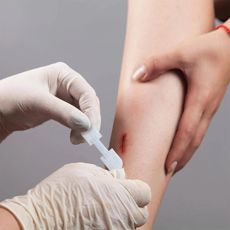 Zipper Band-aid Painless Wound Closure Patch Suture-free Wound Dressing Patches Zip Suture Reducer Band Aid Outdoor Portable