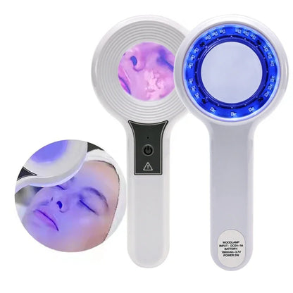 NEW Woods Lamp Skin Analyzer Portable Facial Salon Beauty Analyzer UV Lamp Wood Dermatology for Analyzing Testing Examination