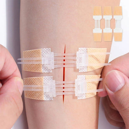 Zipper Band-aid Painless Wound Closure Patch Suture-free Wound Dressing Patches Zip Suture Reducer Band Aid Outdoor Portable