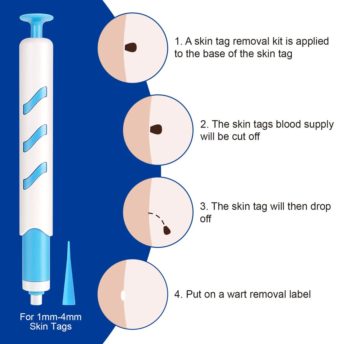 Home Use Painless Safe Skin Tag Mole Wart Spot Removal Equipment for Smooth Skin Wart Remover Eyelid Lifting Acne Treatment Pen