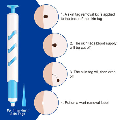 Home Use Painless Safe Skin Tag Mole Wart Spot Removal Equipment for Smooth Skin Wart Remover Eyelid Lifting Acne Treatment Pen