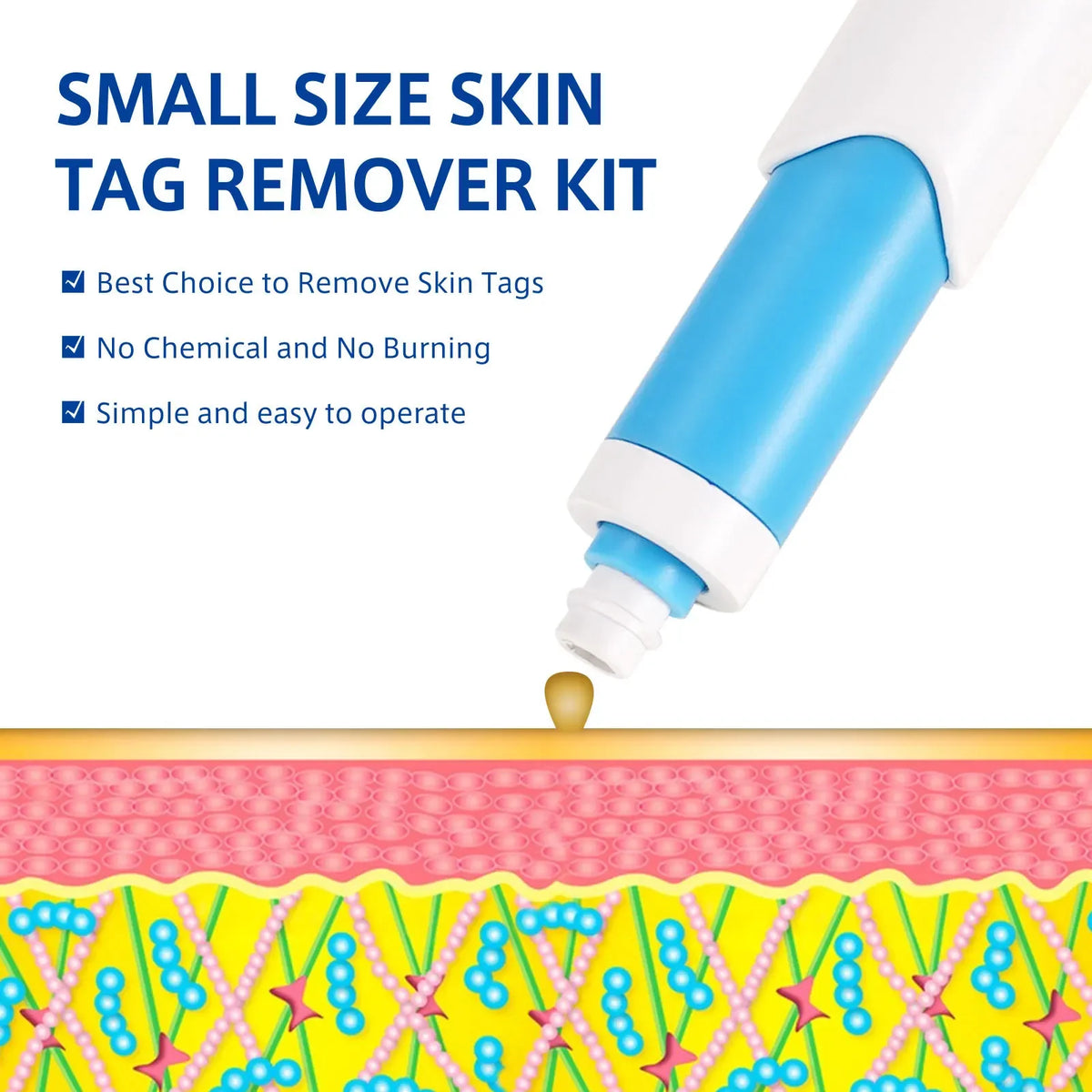 Home Use Painless Safe Skin Tag Mole Wart Spot Removal Equipment for Smooth Skin Wart Remover Eyelid Lifting Acne Treatment Pen