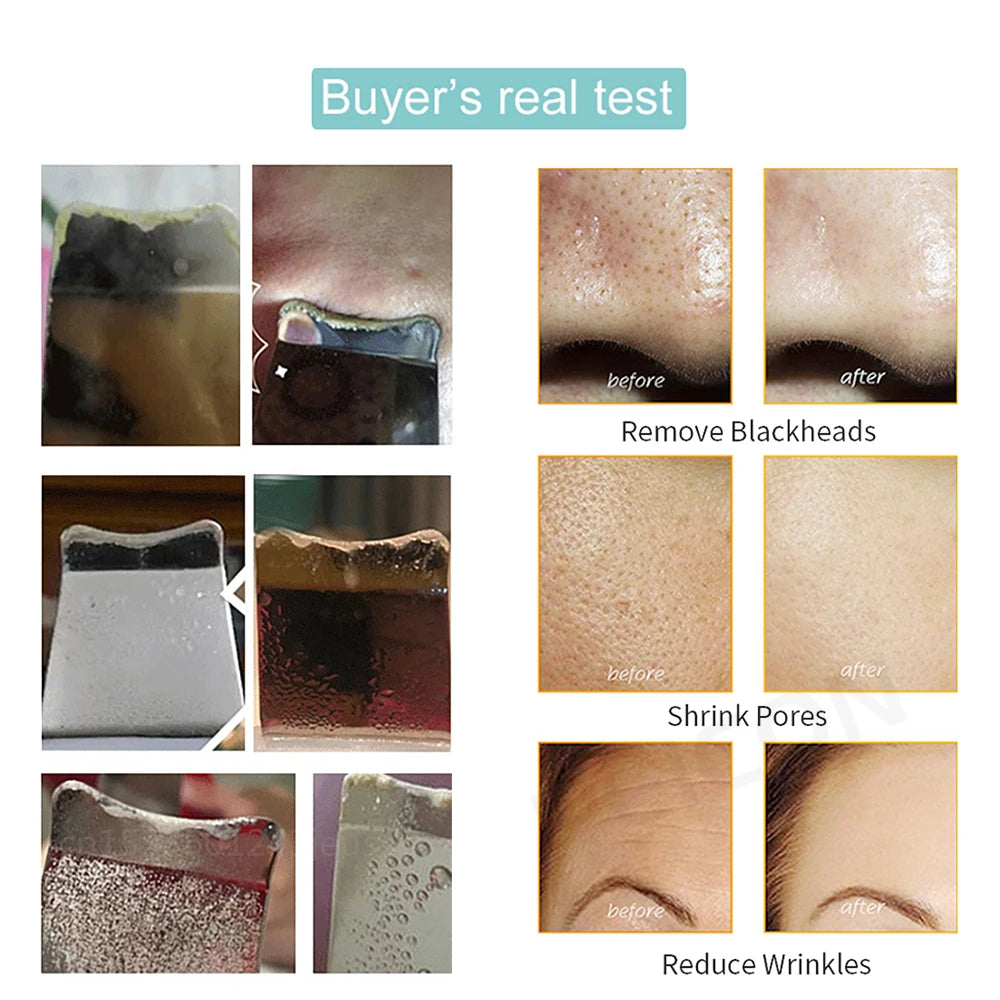 Ultrasonic Skin Scrubber Facial Peeling Face Scrubber Blackhead Remover Ance Pore Deep Facial Cleaning Spatula Facial Cleanser