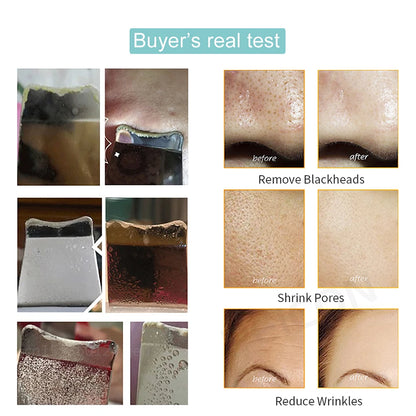 Ultrasonic Skin Scrubber Facial Peeling Face Scrubber Blackhead Remover Ance Pore Deep Facial Cleaning Spatula Facial Cleanser