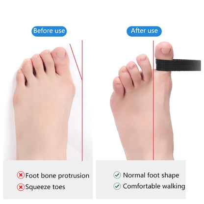 Toe Straightener Hallux Valgus Corrector Belt Foot Stretch Recovery Training Exerciser Strap Thumb Elastic Band Foot Tools