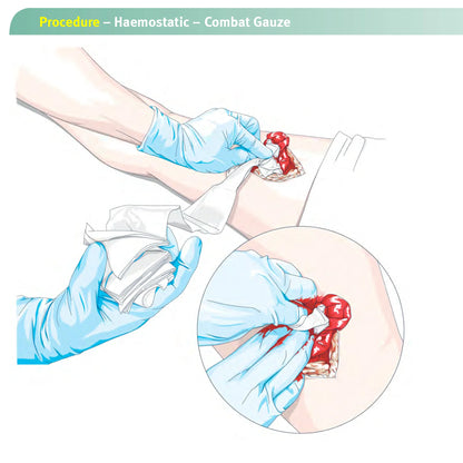 Hemostatic Kaolin Gauze Combat Emergency Trauma Z-Fold Soluble For Ifak Tactical First Aid Kit Medical Wound Dressing