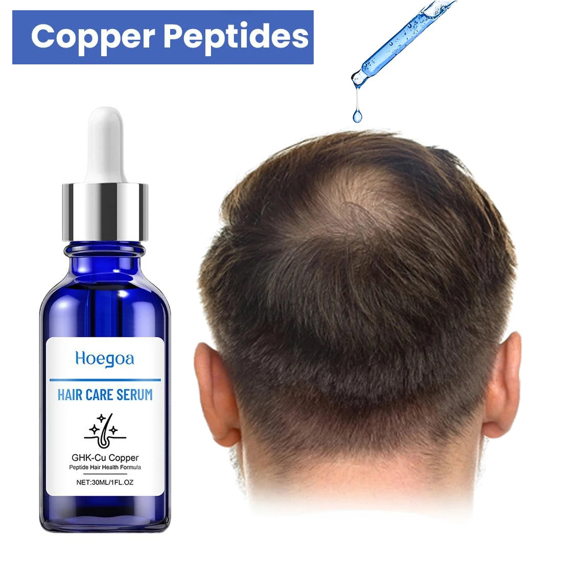 30ML Copper Peptide Serum for Hair Growth, GHK-Cu Peptide Hair Serum Non-Greasy Scalp Care for Thicker Fuller Hair Anti Loss