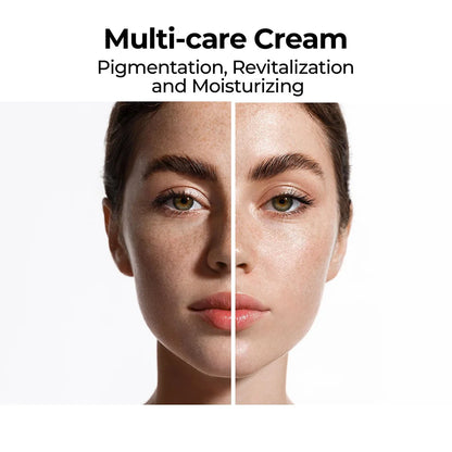 20g Skin Brightening Cream Dark Spot Remover For Face Whitening Freckle Cream Smooth Hydrating Face Moisturizer For Glowing Skin