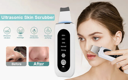 Ultrasonic Skin Scrubber Facial Peeling Face Scrubber Blackhead Remover Ance Pore Deep Facial Cleaning Spatula Facial Cleanser