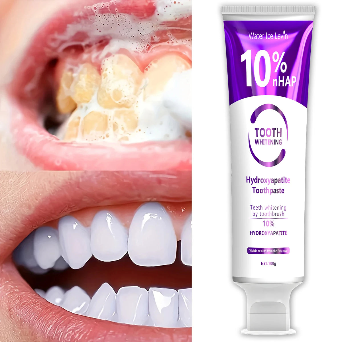 10% Nanoh Hydrogen Oxide Toothpaste, Gently Cleans Teeth with Gently, Brush Your Teeth, Deep Cleansing, Romantic Date, Daily Use, Say Goodbye to Embarrassment, Confident and Speaking